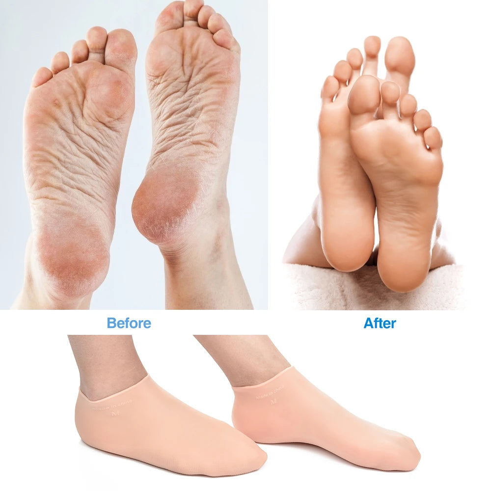 "Ultimate Spa Treatment: Moisturizing Silicone Gel Socks and Gloves for Silky Smooth Feet and Hands - Say Goodbye to Cracked Skin!"